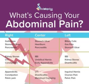 Infographic With Causes of Abdominal Pain findatopdoc.com
